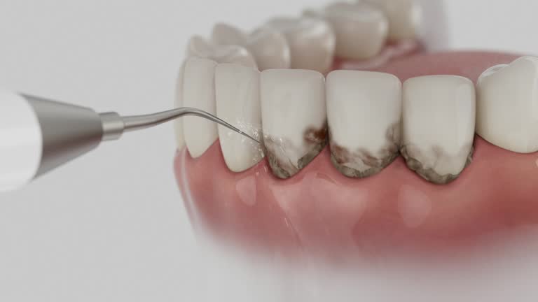 Trusted Wisdom Tooth Removal service in Byron Center, MI - Dentist Open Now